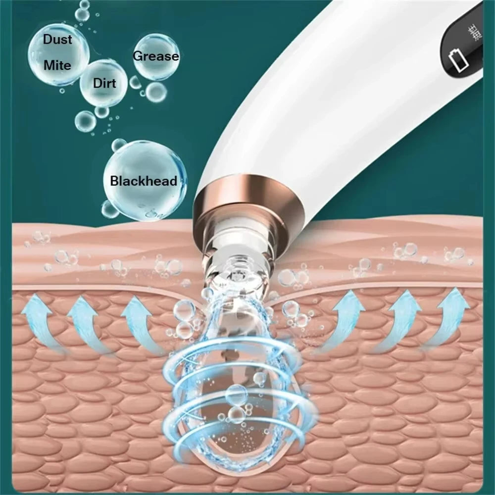 Suction Acne Remover