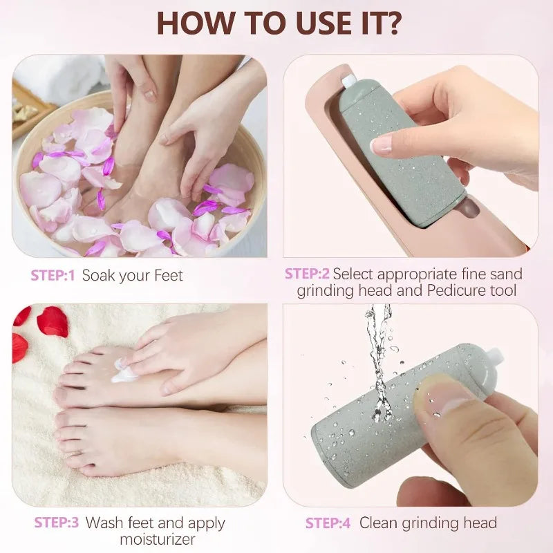 Wireless Callus Remover